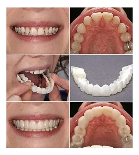 Sorriso Dentes Falsos Folheados W En La Parte Superior/infer
