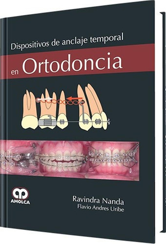 Dispositivos De Anclaje Ortodoncia Nanda