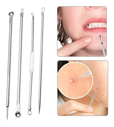 Imagem 3 de 8 de Extrator Removedor Cravo Espinha Kit 4 Agulhas Aço Inox
