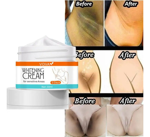 Crema Blanqueadora Privada Para Blanquear Partes De La Piel