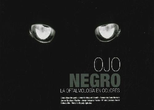 Libro Ojo Negro De Javier Esteban Martín, María Del Carmen T