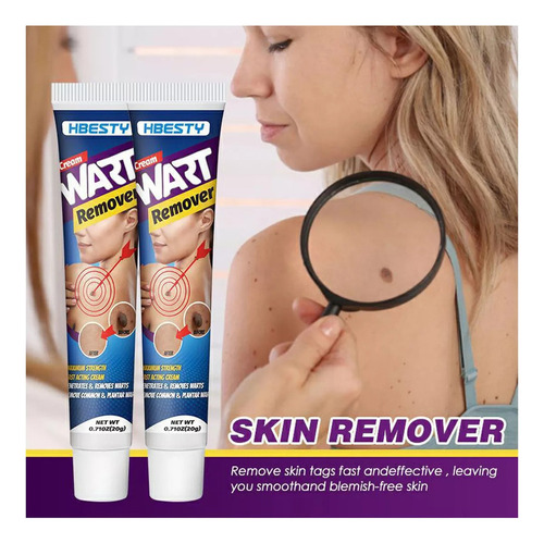 Creme Removedor De Verrugas Na Pele Para Remover Lun