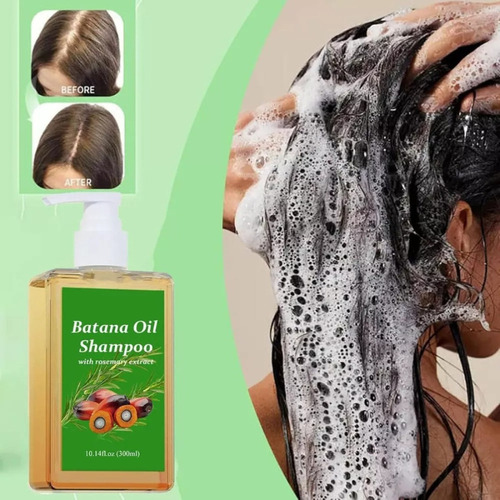 Shampoo De Óleo De Batata, 300 Ml, 1 Frasco