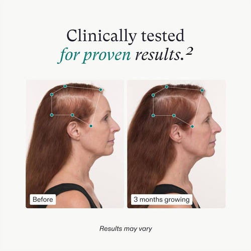 Nutrafol Women's Balance Hair Growth Supplements, Ages 45...
