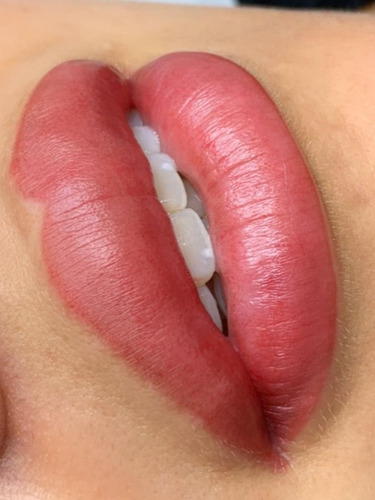 Imagen 3 de 4 de Micropigmentacion Labial