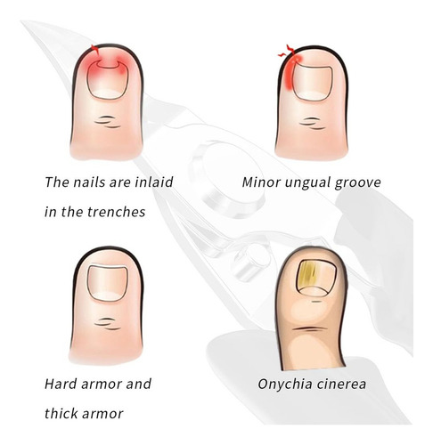 Cuchillo De Uñas Para Dedos De Los Pies Utilizado Para Uñas