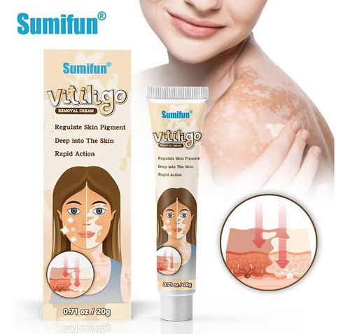 Crema Para Vitiligo  