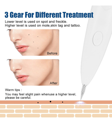 Lápiz Removedor De Marcas Faciales, Verrugas, Manchas Negras