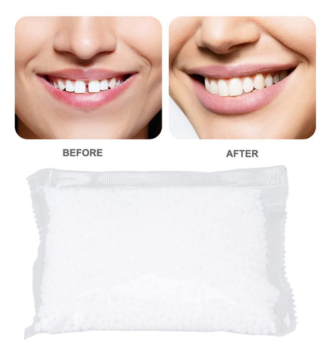 Cuentas De Ajuste Térmico, Cable De Relleno De Dientes De