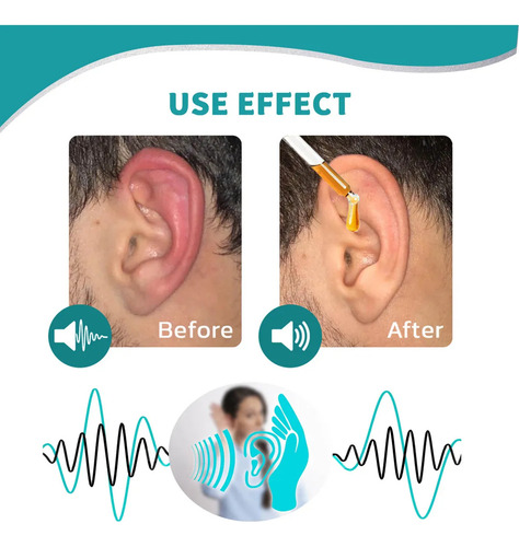 Gotas Para Los Oídos Para El Tinnitus Y El Cuidado De Los Oí