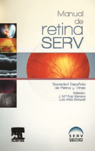 Manual De Retina Serv, De Serv. Editorial Elsevier En Español