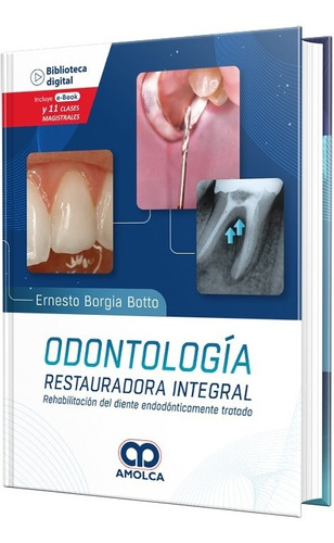 Odontología Restauradora Integral. Rehab. Diente Endodóntica