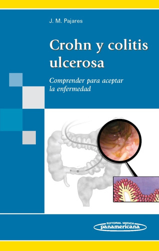 Crohn Y Colitis Ulcerosa - Pajares - Panamericana