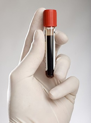 Test Detección Consumo Drogas En Sangre, En Laboratorio