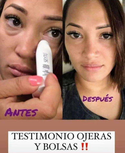 Kit De Sueros Faciales Con Ácido Hialurónico Seytu