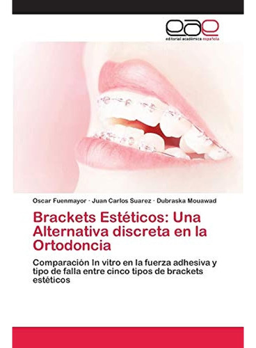 Brackets Estéticos: Una Alternativa Discreta En La Ortodonci