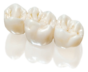 Corona De Porcelana.