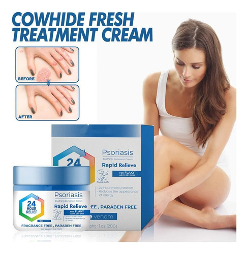 3. Solución Eficaz Para La Psoriasis Eccematoide Sin Tratami