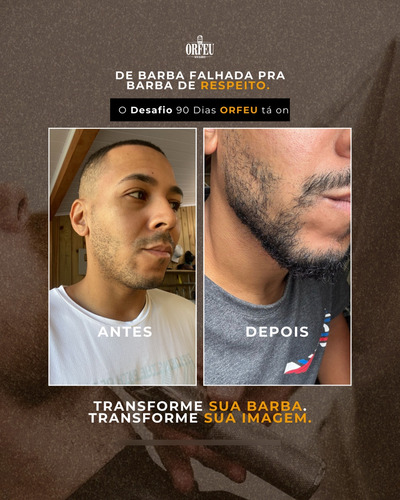 Kit Barba Fechada 90 Dias Sem Falhas E Com Volume
