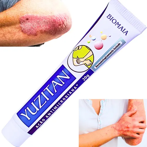 comprar Pomada Psoríase Eczema Dermatite Coceira Alergia Natural