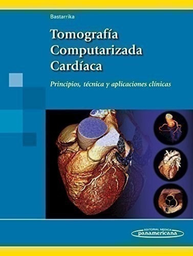 Tomografía Computarizada Cardíaca Principios, Técnica Y Apl