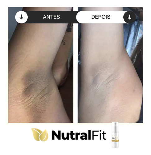Clareador Nutral Fit Corpo E Rosto Concentrado 50ml Já Momento De Aplicação Dia/noite Tipo De Pele Todo Tipo De Pele