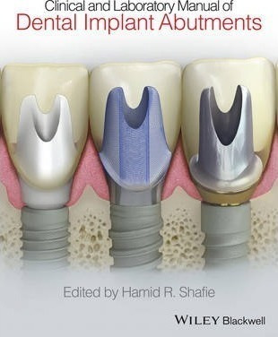 Clinical And Laboratory Manual Of Dental Implant Abutment...