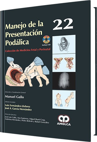 Manejo De La Presentacion Podalica, De Manuel Gallo. Editorial Amolca En Español