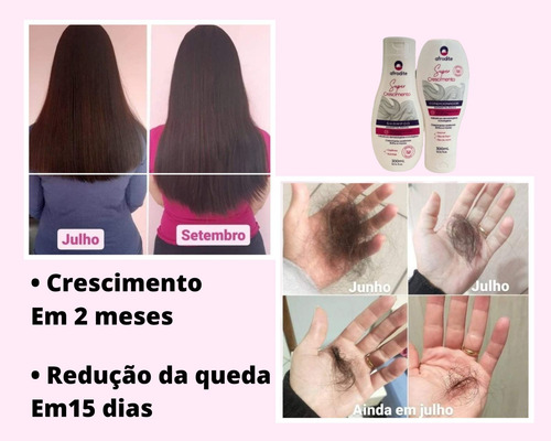 Combo Crescimento E Babosa 2 Shampoo E 2 Condicionador