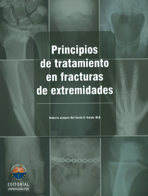 Principios De Tratamiento En Fracturas De Extremidades