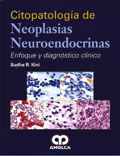 Libro Citopatología De Neoplasias Neuroendócrinas De Sudha R