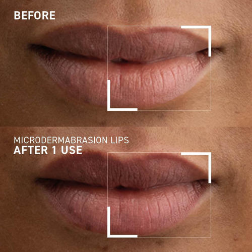 Exfoliante Labial Dr. Brandt Microdermabrasion Suavizante 10