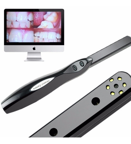 Camara Intraoral Intra Oral Hd Usb 2 Mega Píxeles Ph Ventas
