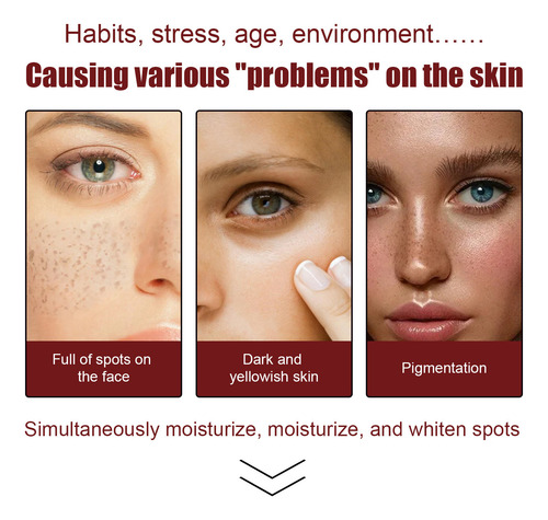 L Blanqueador Y Eliminador De Pecas Aclara Las Pecas Mois 90