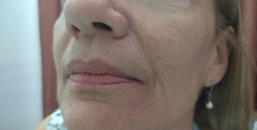 Imagen 9 de 10 de Dermopigmentación A Domicilio; Cejas, Parpados & Labios.