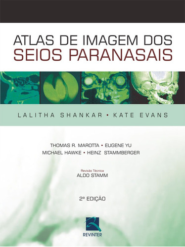 Atlas de Imagem dos Seios Paranasais, de Shankar, Lalitha. Editora Thieme Revinter Publicações Ltda, capa dura em português, 2007