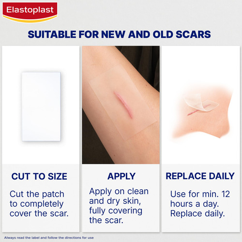 Emplastros Redutores De Cicatrizes, Elastoplasto, Tratamento