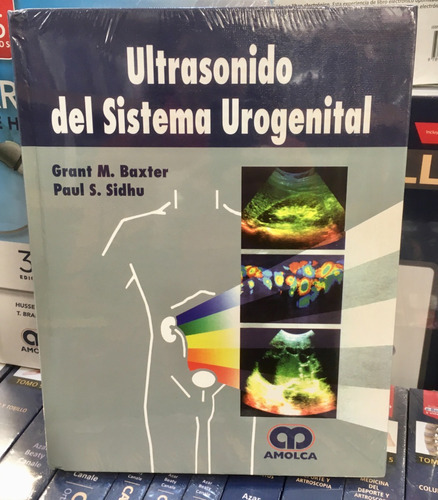 Ultrasonido Del Sistema Urogenital Baxter 