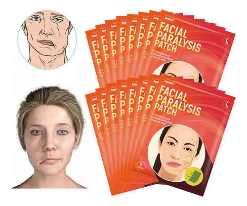 16 Massagens Eficazes Para Corrigir A Paralisia Facial Com P