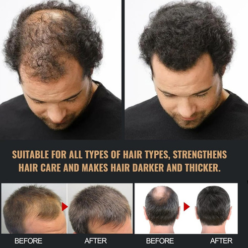Fa Champú De Regeneración De Cabello Activado Por La Raíz 1