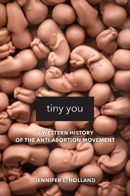 Libro Tiny You : A Western History Of The Anti-abortion M...