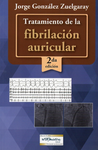 Tratamiento De La Fibrilación Auricular. González Zuelgaray