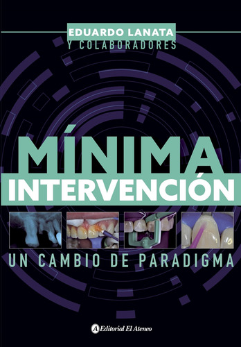 Minima Intervencion - Eduardo Lanata