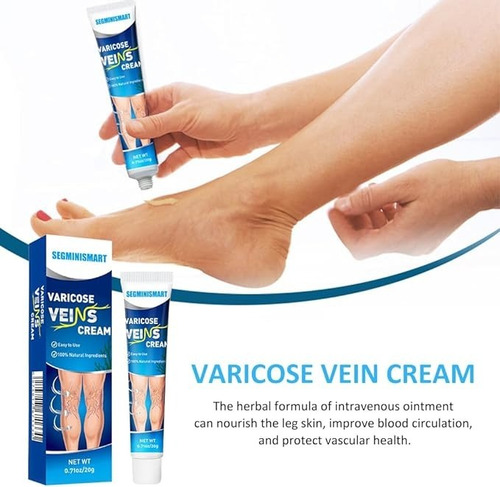 Crema Para Venas Varicosas