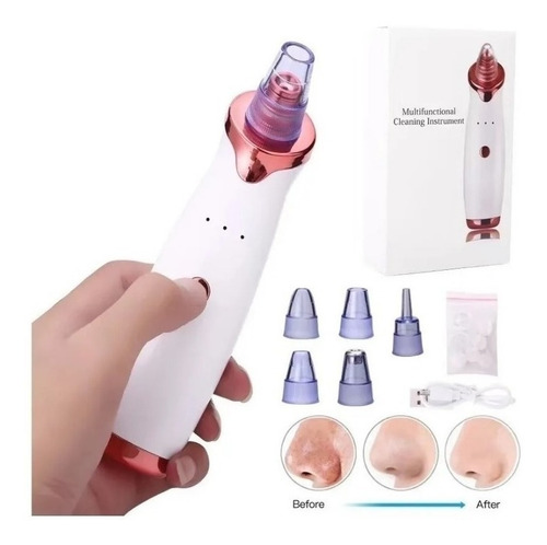 Imagen 4 de 10 de Extractor Exfoliante De Puntos Negros + Tratamiento X60 Dias