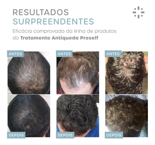 Tonico Poderoso Tratamento Capilar Para Crescer Cabelo