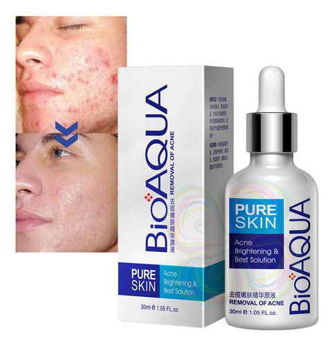 Serum Anti Acne Anti Manchas Puntos Negros Bioaqua Skin Pure