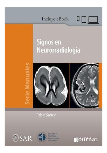 Signos En Neurorradiologia