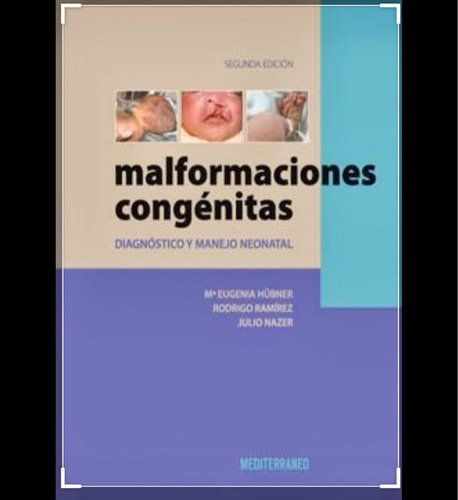 Malformaciones Congenitas