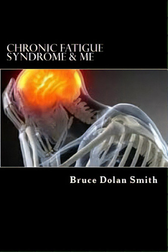 Chronic Fatigue Syndrome And Me, De Smith, Bruce Dolan. Editorial Createspace, Tapa Blanda En Inglés